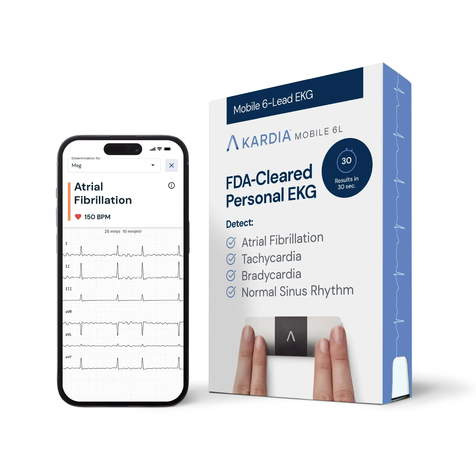 AliveCor KardiaMobile 6L ECG di livello medico | ECG portatile a 6 derivazioni | Rileva fibrillazione atriale, bradicardia e tachicardia in soli 30 secondi | Distribuito da OMRON