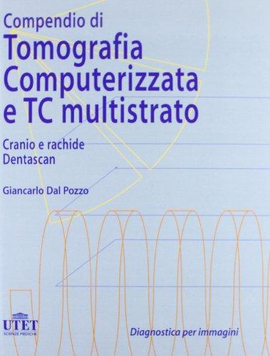 Compendio di tomografia computerizzata e TC multistrato. Cranio, rachide