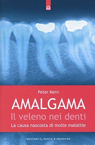 Amalgama il veleno nei denti