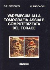 Vademecum alla Tomografia Assiale Computerizzata del Torace