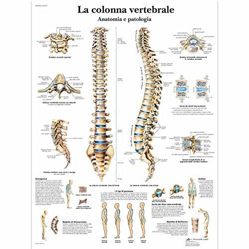 3B Scientific VR4152L - La Colonna Vertebrale: Anatomia e Patologia - Poster Anatomico Plastificato
