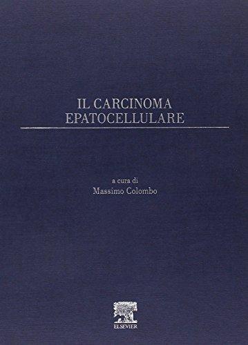 Il carcinoma epatocellulare - Massimo G. Colombo