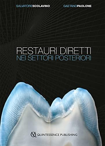 Restauri Diretti nei Settori Posteriori: Guida Completa per l'Odontoiatra Moderno
