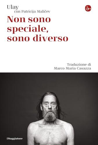 Non sono speciale, sono diverso