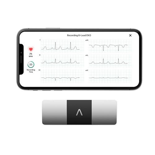 AliveCor KardiaMobile 6L ECG di livello medico | ECG portatile a 6 derivazioni | Rileva fibrillazione atriale, bradicardia e tachicardia in soli 30 secondi | Distribuito da OMRON