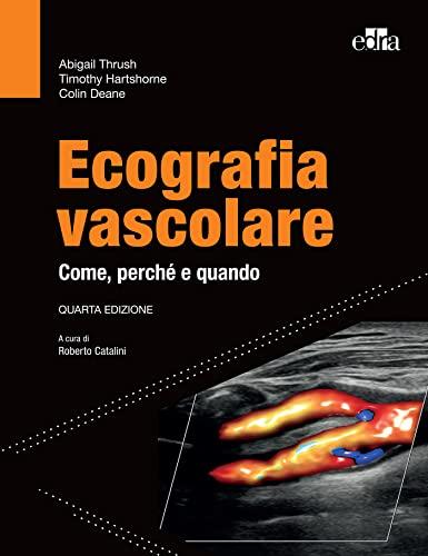 Ecografia vascolare: Come, perché e quando